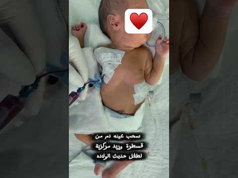 سحب عينة دم من سنتر لاين او CVC #nurse #hospital