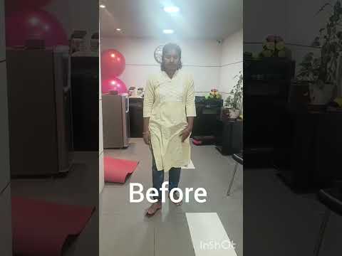 Post quadriceps strain patient feedback: Arogya physiotips #quadriceps