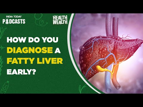 Why should I worry if my fatty liver is reversible? | Health Wealth, Ep 63 | Podcasts