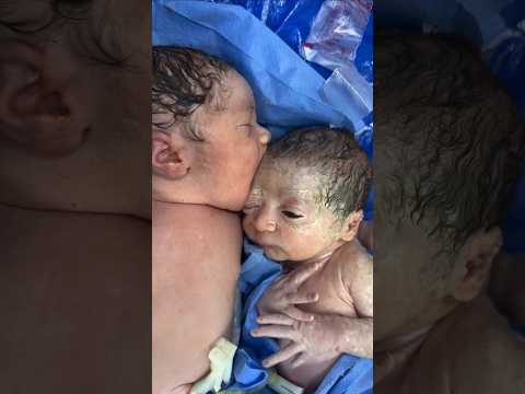 Why does the doctor bring three newborn's together? #shorts