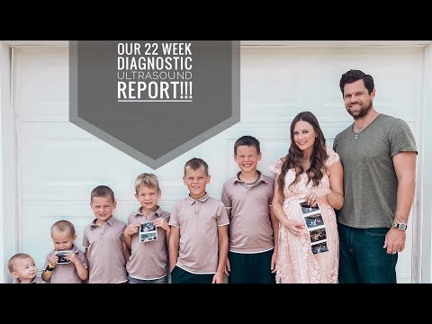 Our Big Diagnostic Ultrasound for our 8th pregnancy!!!
