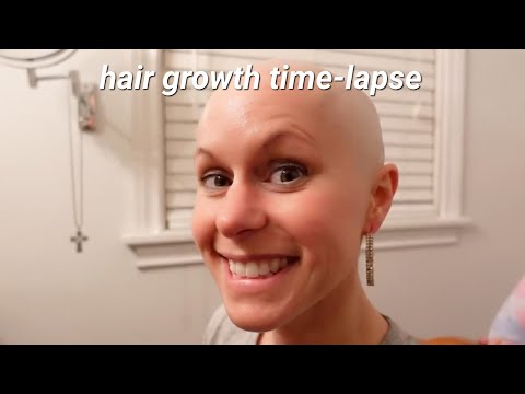 Completely BALD 1 Year Timelapse Hair Growth