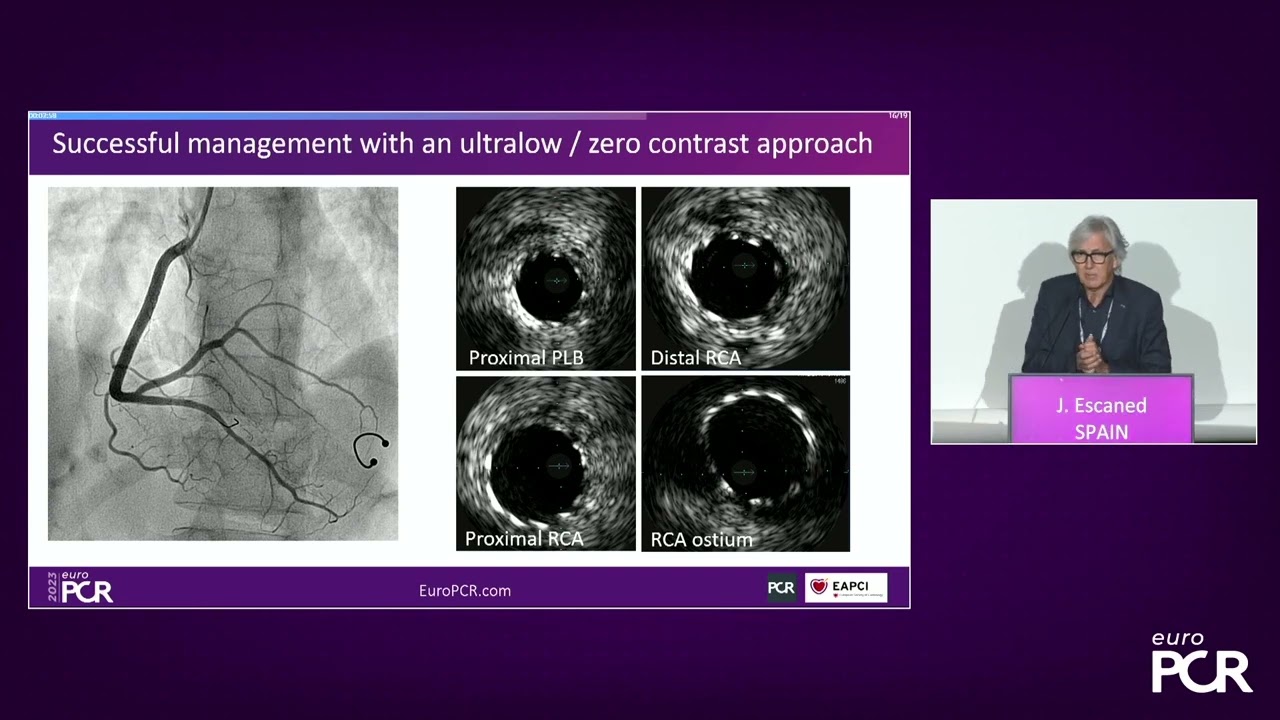 Ultra-low contrast PCI