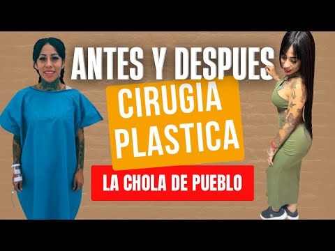 CIRUGÍA PLÁSTICA EL ANTES Y DESPUÉS DE LA CHOLA