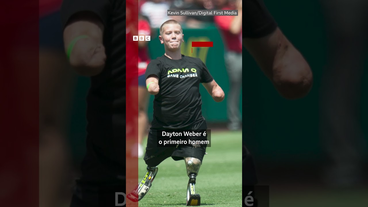 Atleta com braços e pernas amputados é acusado de homicídio após tiroteio dentro de carro nos EUA TV Online Atleta com braços e pernas amputados é acusado de homicídio após tiroteio dentro de carro nos EUA