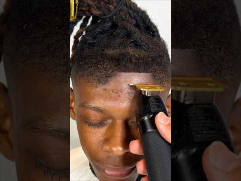 Why dreads are dangerous for your hairline