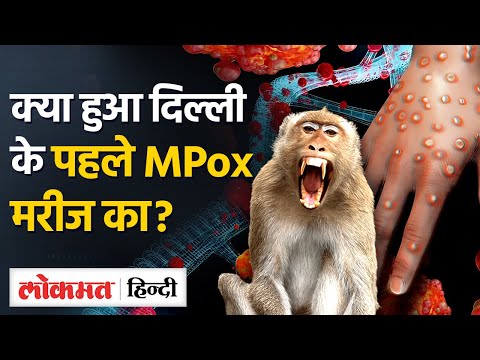 MPox का Delhi में पहला मरीज हालत में सुधार हुआ दर्ज I TW