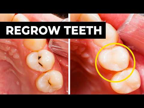 Regrowing vs Remineralizing Tooth Enamel