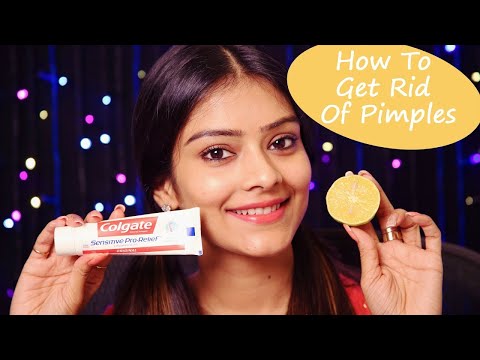 How To Get Rid Of Pimples | DIY Face Mask for Acne | Remove Acne | Foxy Makeup Tutorial