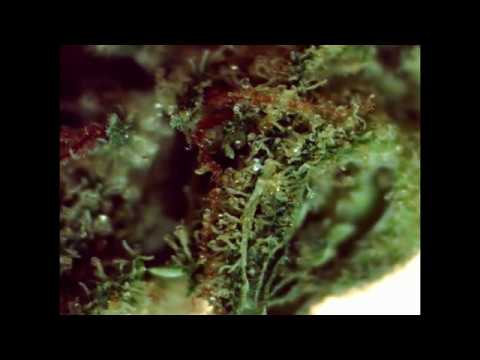 Cannamedical Indica: Sirius Farbenspiel der Trichome (Tilray/Alien Dawg) Mikroskop 80-160X
