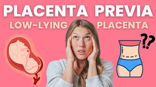 PLACENTA PREVIA??? WATCH THIS FOR INSTANT CONFIDENCE