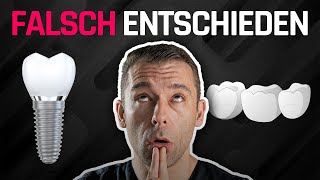 Implantat vs. Brücke: Was ist die beste Lösung?