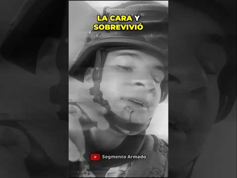 Recibe un disparo en la cara y SOBREVIVE #jalisco #short #guadalajara #datoscurisos