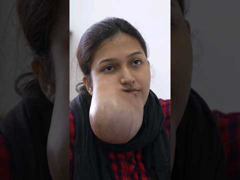 Facial Tumor Examination