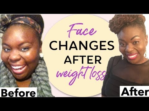 Face Changes After  EXTREME Weight Loss! (What Losing Weight Did to My Face!)