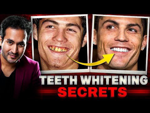 Celebrity TEETH WHITENING Secrets Revealed | Whiten 20 Shades in 1 Week