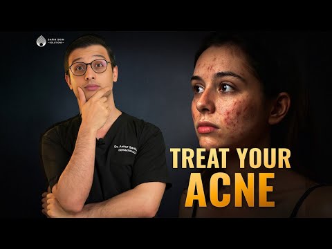 Acne treatment at home | Real Suggestions by a Dermatologist |