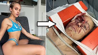 Model's Face Shattered in Bizarre Pigeon Crash