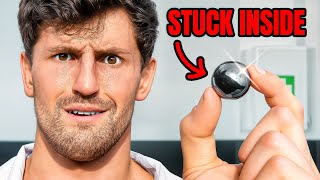 I Had Surgery... It Didn't Go As Planned