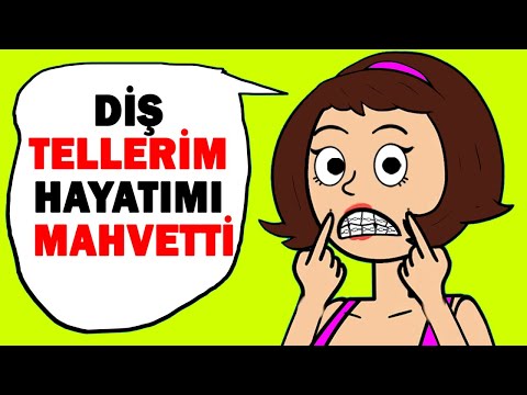 Diş Telleri Taktıktan Sonra Hayatım Mahvoldu! / Hikayem Bitmedi