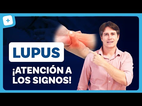 LUPUS: qué es, síntomas y tratamiento