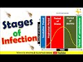Stages of Infection and Recovery