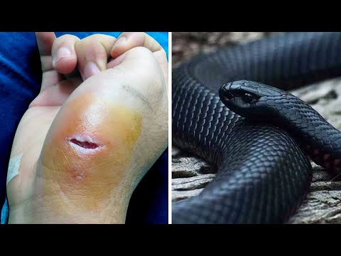10 COBRAS MAIS VENENOSAS DO MUNDO