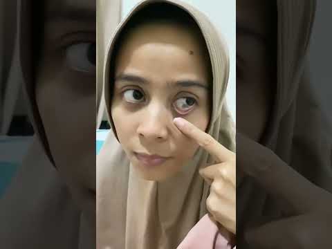 Mata kena tinta #fypage #adayinmylife #minivlog #vlog #shortvideo