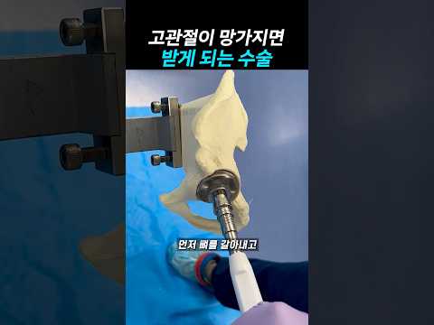 고관절이 망가지면 받게 되는 <strong>수술</strong>