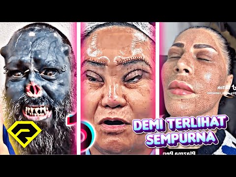 DEMI SEMPURNA, BERAKHIR MERANA?! Ini 8 Manusia Dengan Tampilan Paling TAK MASUK AKAL!!