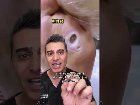 Doctor SHOCKED When He Sees What's Wrong with This Foot!