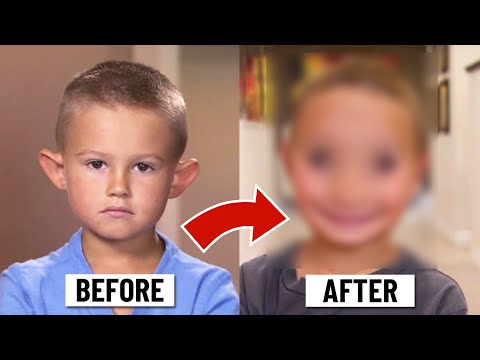 Why are these kids getting plastic surgeries?!