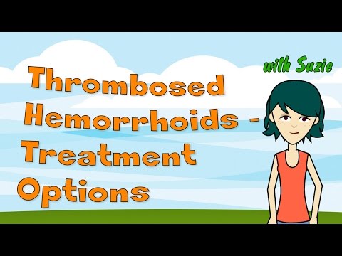 Thrombosed Hemorrhoids - Treatment Options to Stop the...