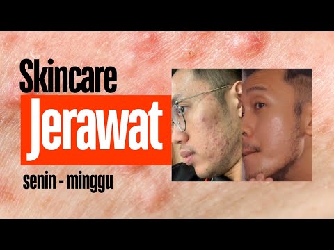 Cara Pakai Skincare untuk jerawat