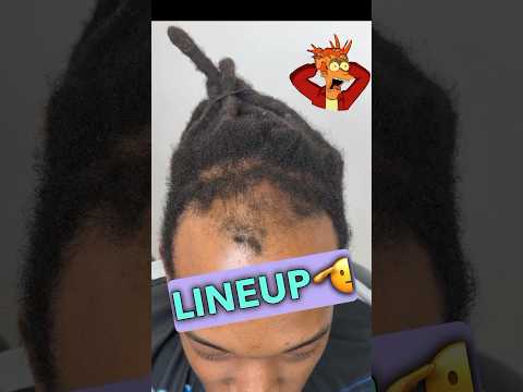 $100 Hairline Fix #haircut