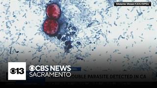 YouTube video thumbnail: California Cases Remain Within Normal Range Amid U.S. Cyclospora Outbreak, Expert Says