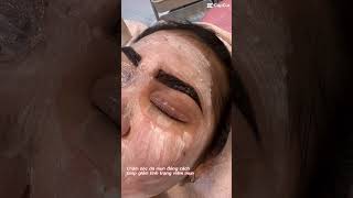 💥 LẤY NHÂN MỤN CHUYÊN SÂU – DA SẠCH THOÁNG, TỰ TIN TỎA SÁNG 💥