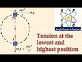 Centripetal Force and Tension Concepts