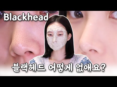 피부과 가지마😭 '홈케어' 요철+피지 블랙헤드 없애는 방법 (+이벤트) | 미소정 MiSoJeong