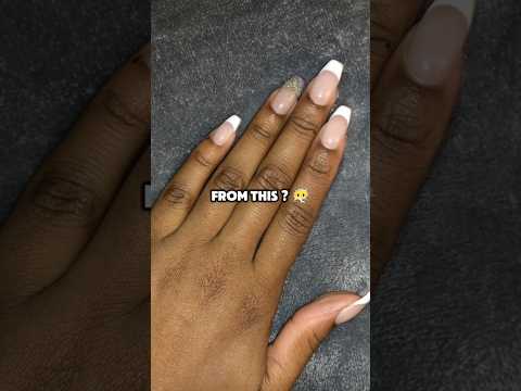 Fair Hand Tips & Trick | Remove Hand Darkness & Tanning #youtubeshorts #ytshorts #shorts