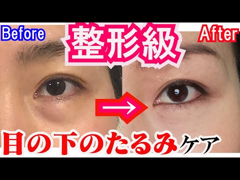 【500万再生】1週間で激変！目の下のたるみをとるマッサージ＆エクササイズ夜の美顔ヨガ