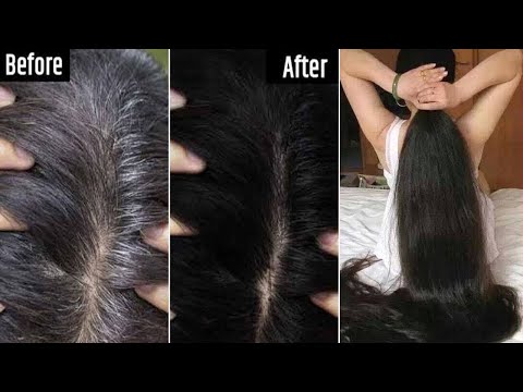 White Hair To Black Permanently in 30 Minutes Naturally | Coffee For Jet Black At Home | 100% Works