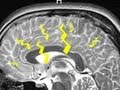 Understanding Dreams and Their Science