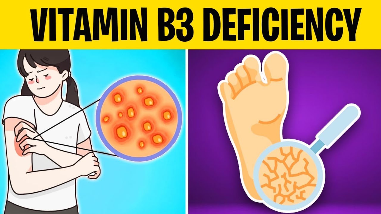 Are You Vitamin B3 Deficient? Look Out for These Signs!