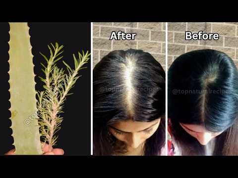 DIY Aloe Vera and Rosemary Water for Hair Growth | Natural Remedy for Stronger, Thicker Hair