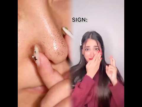 Everyone gets different colour marks Full story Part 1 #thebrownsiblings #ytshorts #shortstory