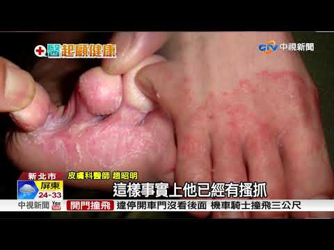 高筒雨靴防濕.不透氣 女性罹香港腳增多│中視新聞20171015 - YouTube