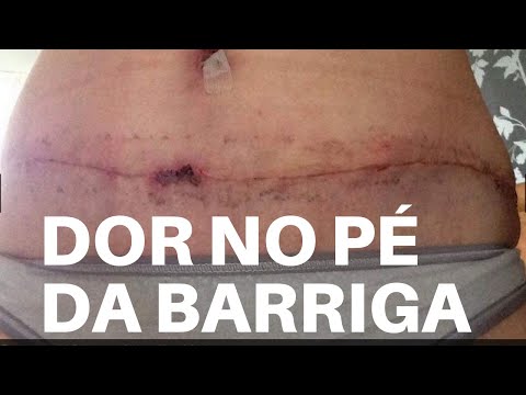 DOR NO PÉ DA BARRIGA É NORMAL?
