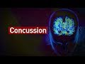 Understanding Concussions and Their Effects