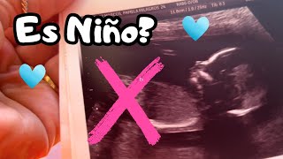 Ya NO es una NIÑA!? 🎀 NUEVA ECO  para CONFIRMAR!  Así reaccionó mi HIJA  y mi familia 🥹